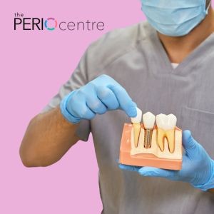 dental implant periodontist