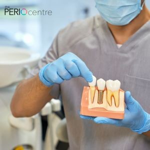 dental implants oshawa