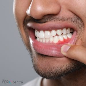 gum disease treatment