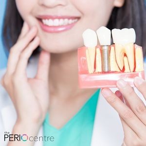 dental implants oshawa
