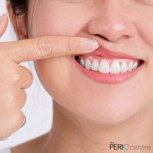 periodontist whitby